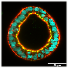 Mechanics of induced pluripotent stem cell cysts
