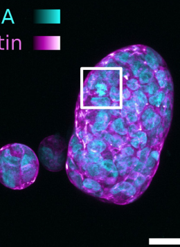 NEW PUBLICATION IN LAB ON A CHIP